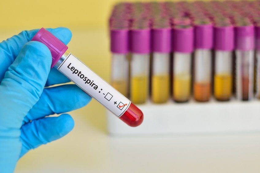 diagnostyka leptospirozy